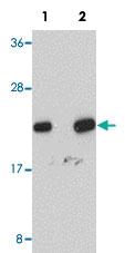 Anti-NDUFB9 Rabbit Polyclonal Antibody