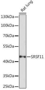 Western blot analysis of extracts of Rat lung, using Anti-SFRS11 Antibody (A308707) at 1:1,000 dilution