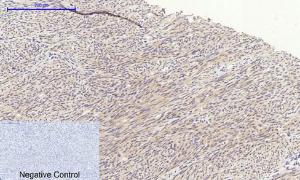 Immunohistochemical analysis of paraffin-embedded human uterus tissue using Anti-GSK3 beta Antibody at 1:200 (4°C overnight). Negative control was secondary antibody only.