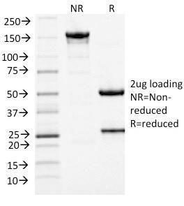 SDS-PAGE analysis of Anti-MCM7 Antibody [MCM7/1467] under non-reduced and reduced conditions; showing intact IgG and intact heavy and light chains, respectively SDS-PAGE analysis confirms the integrity and purity of the antibody