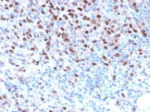 Anti-MiTF Rabbit Recombinant Antibody [clone: MITF/2987R]