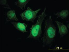 Anti-PPP3R1 Mouse Monoclonal Antibody [clone: 4E1]