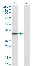 Anti-SNAI1 Mouse Monoclonal Antibody [clone: 1A5]