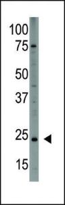 Anti-PDGFA Rabbit Polyclonal Antibody (HRP (Horseradish Peroxidase))