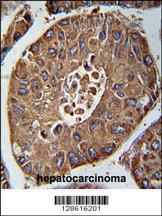 Anti-ACN9 Rabbit Polyclonal Antibody (AP (Alkaline Phosphatase))