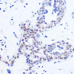 Immunohistochemistry analysis of paraffin-embedded human breast tissue using Anti-SFRS11 Antibody (A308707) at a dilution of 1:100 (40X lens). Perform microwave antigen retrieval with 10 mM PBS buffer pH 7.2 before commencing with IHC staining protocol