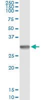 Anti-SNAI1 Mouse Monoclonal Antibody [clone: 1A5]