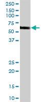 Anti-CHEK2 Rabbit Polyclonal Antibody