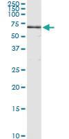 Anti-ANGPTL3 Antibody Pair