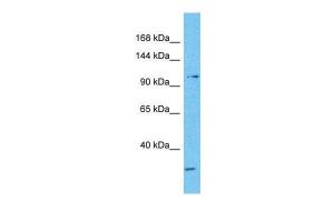 Anti-NFATC3 Rabbit Polyclonal Antibody