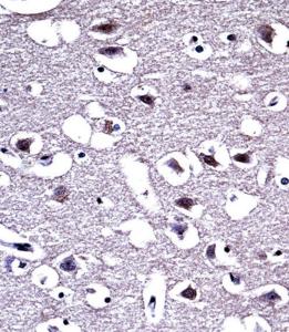 Anti-OPRM1 Rabbit Polyclonal Antibody