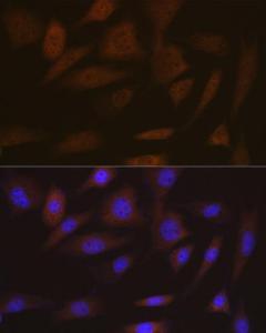 Immunofluorescence analysis of NIH-3T3 cells using Anti-SMC4 Antibody [ARC2042] (A305900) at a dilution of 1:100 (40x lens) DAPI was used to stain the cell nuclei (blue)