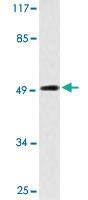 Anti-SUPT3H Rabbit Polyclonal Antibody