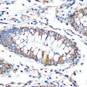 Immunohistochemistry analysis of paraffin-embedded human colon tissue using Anti-FOXO3A Antibody (A11106) at a dilution of 1:50 (40x lens) Perform microwave antigen retrieval with 10 mM PBS buffer pH 72 before commencing with IHC staining protocol