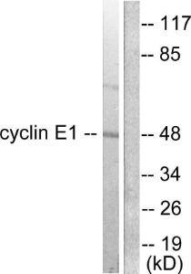 Anti-Cyclin E1 Rabbit Polyclonal Antibody