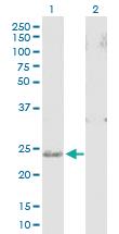 Anti-SNAP25 Mouse Polyclonal Antibody