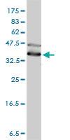 Anti-DNAJA4 Mouse Monoclonal Antibody [clone: 4B4-1F2]