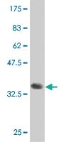 Anti-MAP4K4 Mouse Monoclonal Antibody [clone: 4F8]