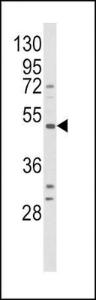 Anti-BDKRB1 Rabbit Polyclonal Antibody (HRP (Horseradish Peroxidase))