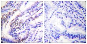 Anti-Cyclin E1 Rabbit Polyclonal Antibody