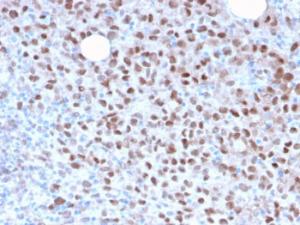 Anti-MiTF Rabbit Recombinant Antibody [clone: MITF/2987R]