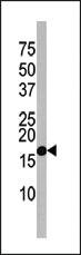 Anti-MAP1LC3A Rabbit Polyclonal Antibody