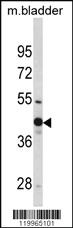 Anti-WNT4 Rabbit Polyclonal Antibody