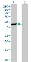 Anti-CTH Mouse Monoclonal Antibody [clone: 4E1-1B7]