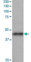 Anti-ACTR1B Goat Polyclonal Antibody