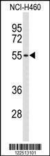 Anti-ASIC2 Rabbit Polyclonal Antibody (AP (Alkaline Phosphatase))