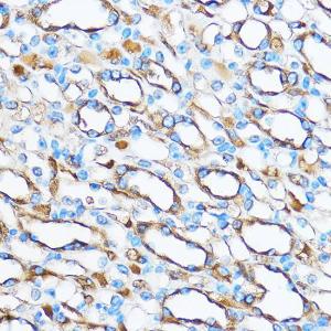 Immunohistochemistry analysis of paraffin-embedded mouse kidney using Anti-FOXO3A Antibody (A11106) at a dilution of 1:50 (40x lens) Perform microwave antigen retrieval with 10 mM PBS buffer pH 72 before commencing with IHC staining protocol