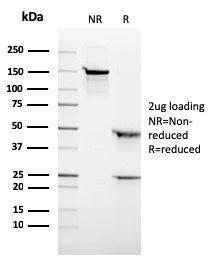 SDS-PAGE analysis of Anti-ALK Antibody [ALK/3218R] under non-reduced and reduced conditions; showing intact IgG and intact heavy and light chains, respectively. SDS-PAGE analysis confirms the integrity and purity of the Antibody