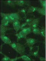 Anti-MAP1LC3A Rabbit Polyclonal Antibody