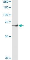 Anti-ACOX1 Polyclonal Antibody Pair