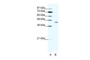 Anti-LDB2 Rabbit Polyclonal Antibody