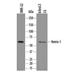 Anti-Netrin-1 Sheep Polyclonal Antibody