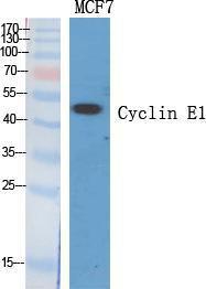 Anti-Cyclin E1 Rabbit Polyclonal Antibody