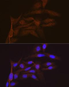 Immunofluorescence analysis of U-2 OS cells using Anti-SMC4 Antibody [ARC2042] (A305900) at a dilution of 1:100 (40x lens) DAPI was used to stain the cell nuclei (blue)