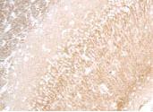 Anti-MAP1LC3A Rabbit Polyclonal Antibody