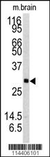 Anti-NTF3 Rabbit Polyclonal Antibody