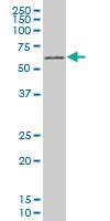 Anti-TBX18 Mouse Monoclonal Antibody [clone: 3C12]