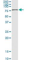 Anti-CHEK2 Rabbit Polyclonal Antibody