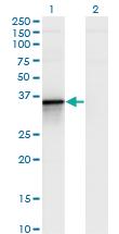 Anti-BCL2L14 Mouse Monoclonal Antibody [clone: 1D11]