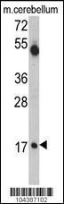 Anti-UBE2V1 Rabbit Polyclonal Antibody (FITC (Fluorescein))