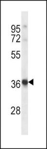 Anti-HRH2 Rabbit Polyclonal Antibody (APC (Allophycocyanin))