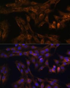 Immunofluorescence analysis of C6 cells using Anti-FOXO3A Antibody (A11106) at dilution of 100 (40x lens) DAPI was used to stain the cell nuclei (blue)