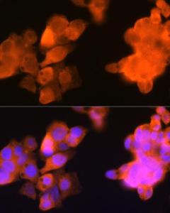 Immunofluorescence analysis of Hep G2 cells using Anti-AKR1C3 Antibody [ARC0857] (A308711) at a dilution of 1:100 (40x lens). DAPI was used to stain the cell nuclei (blue).