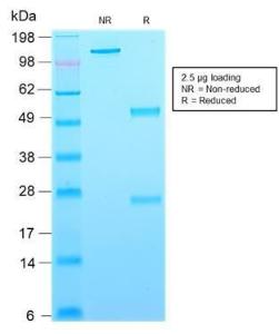 SDS-PAGE analysis of Anti-CD63 Antibody [rMX-49.129.5] under non-reduced and reduced conditions; showing intact IgG and intact heavy and light chains, respectively. SDS-PAGE analysis confirms the integrity and purity of the antibody.