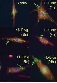 Anti-LC3B Rabbit Polyclonal Antibody