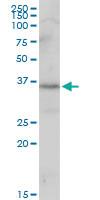 Anti-SNAPC1 Mouse Polyclonal Antibody